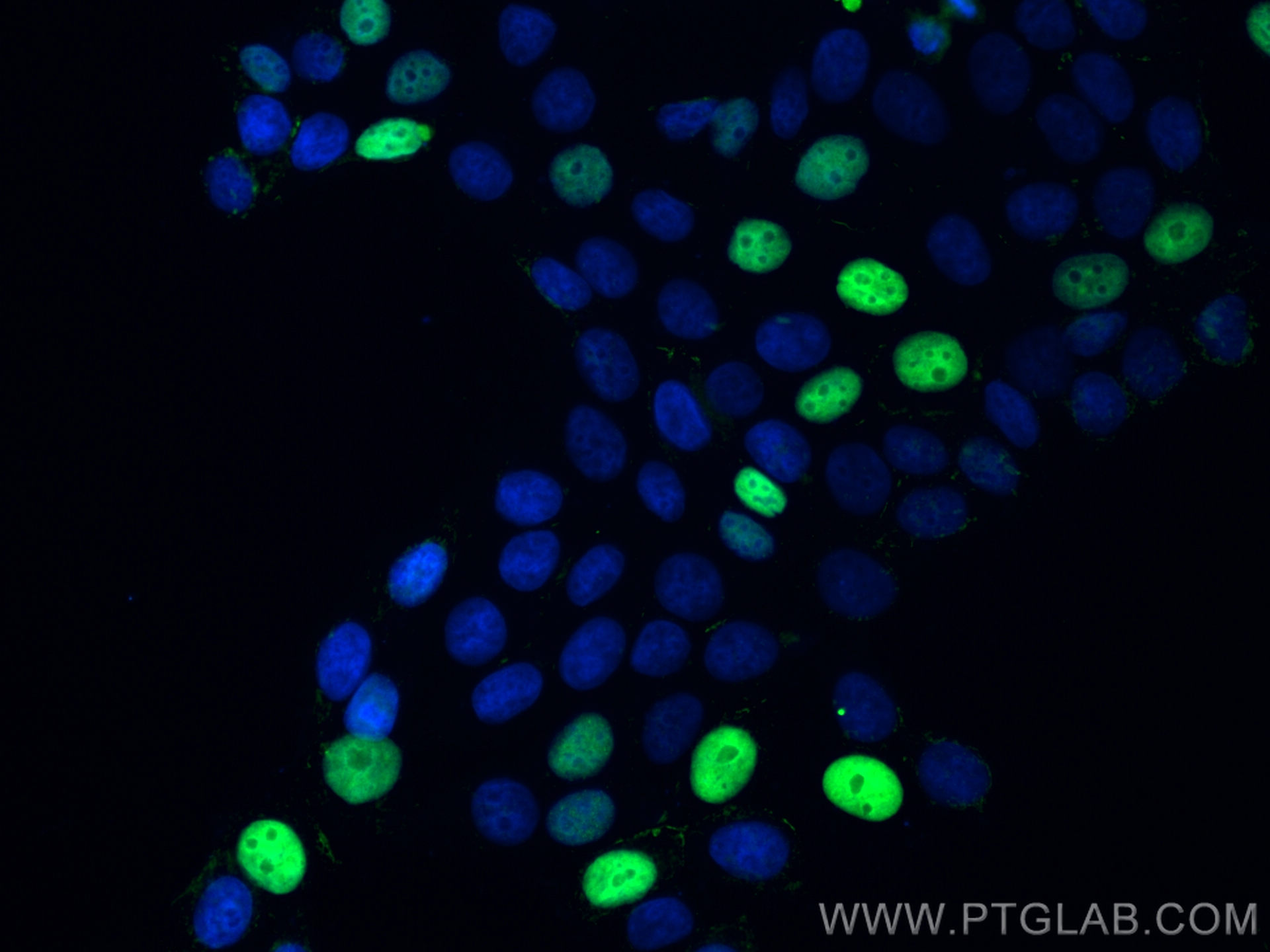 IF Staining of MCF-7 using 27296-1-AP