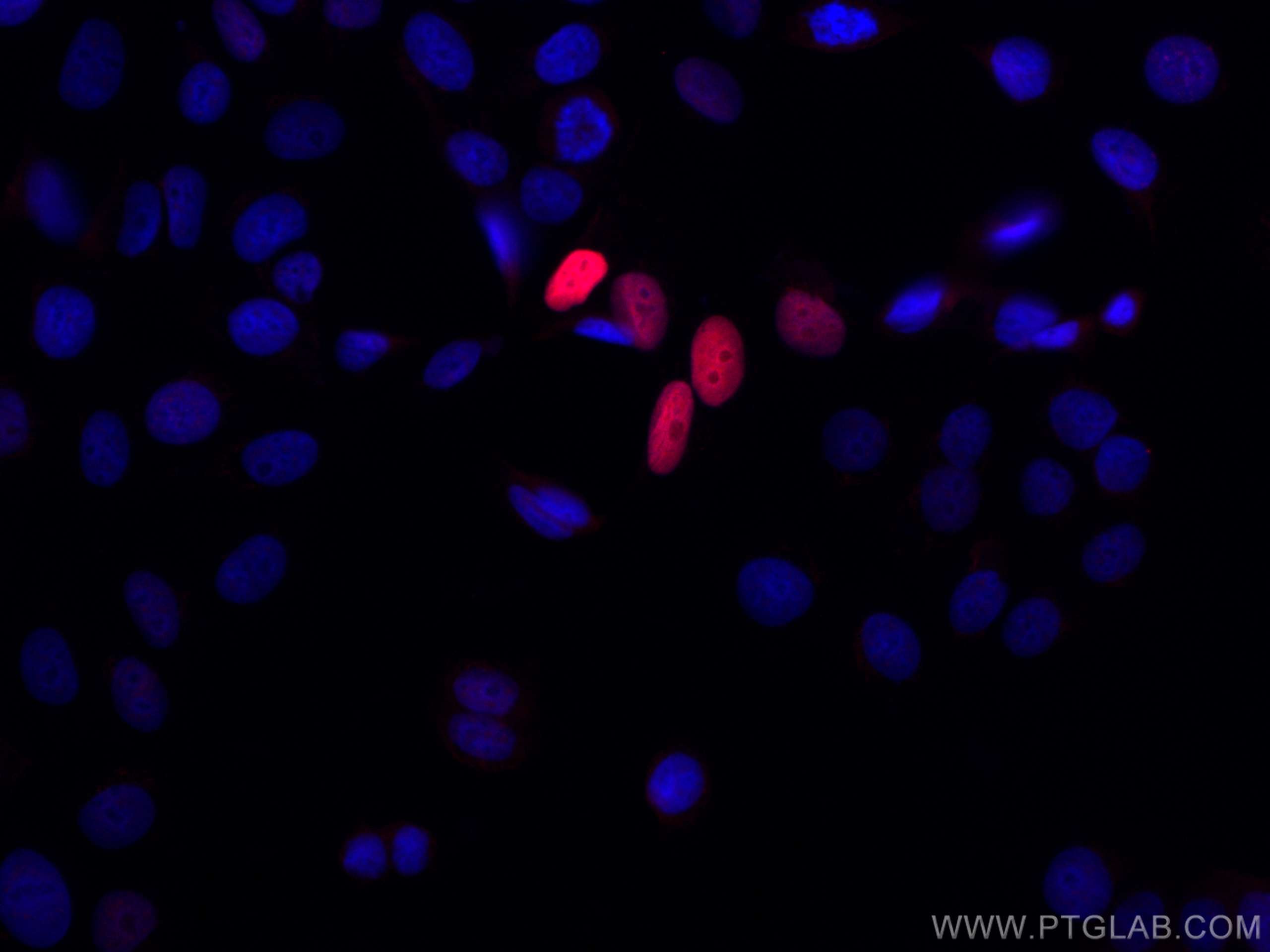 IF Staining of MCF-7 using CL594-10355