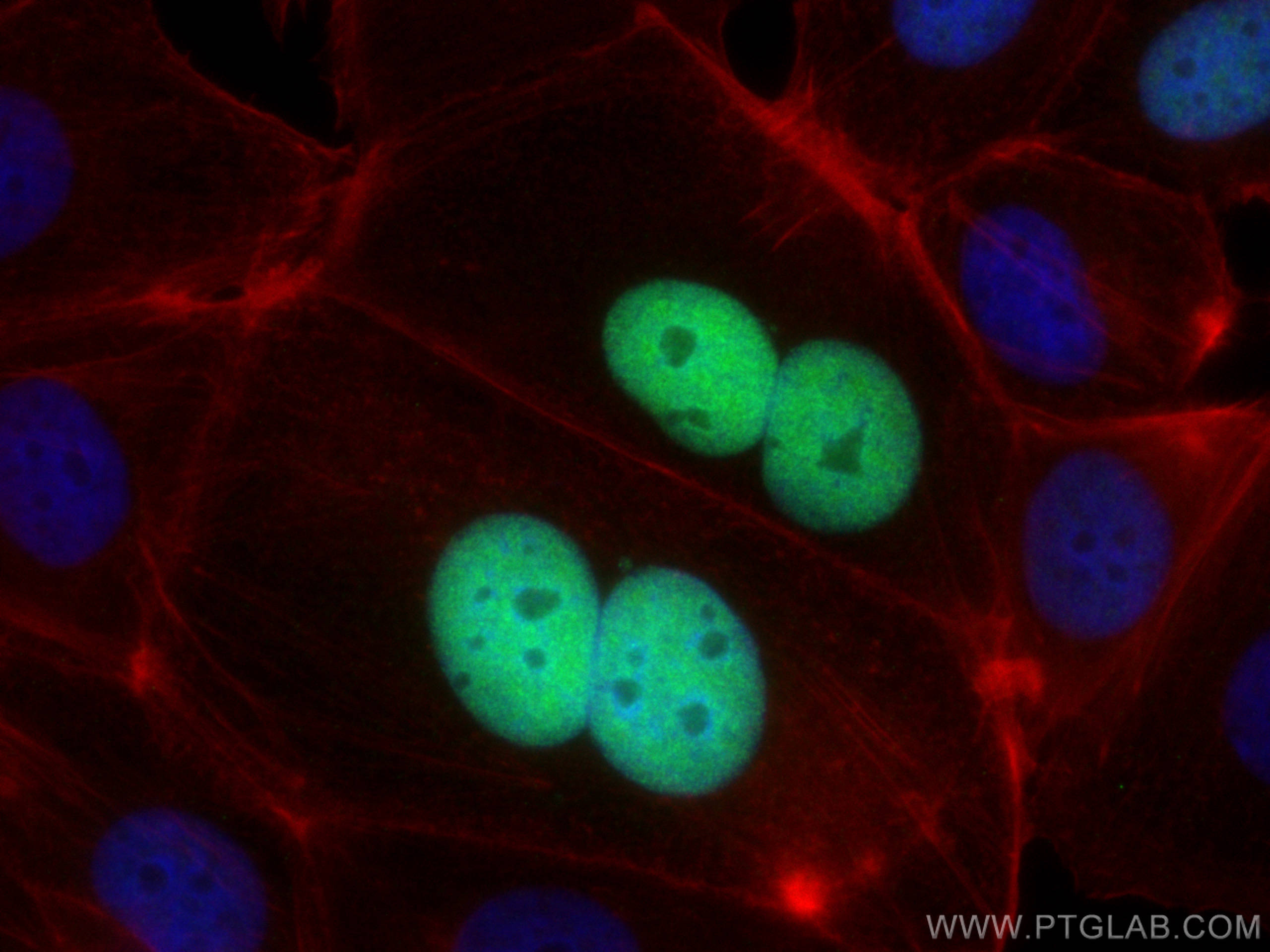 IF Staining of MCF-7 using 82669-2-RR