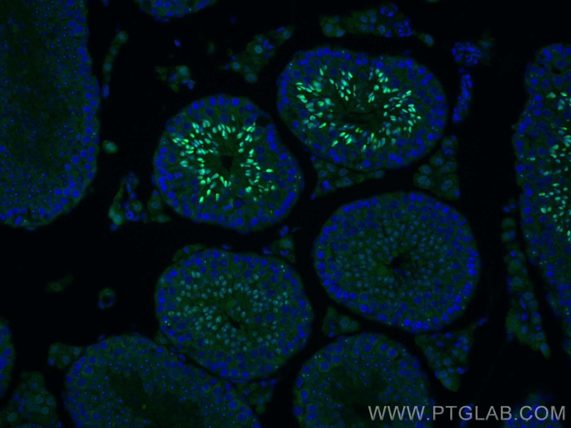 IF Staining of mouse testis using 25614-1-AP
