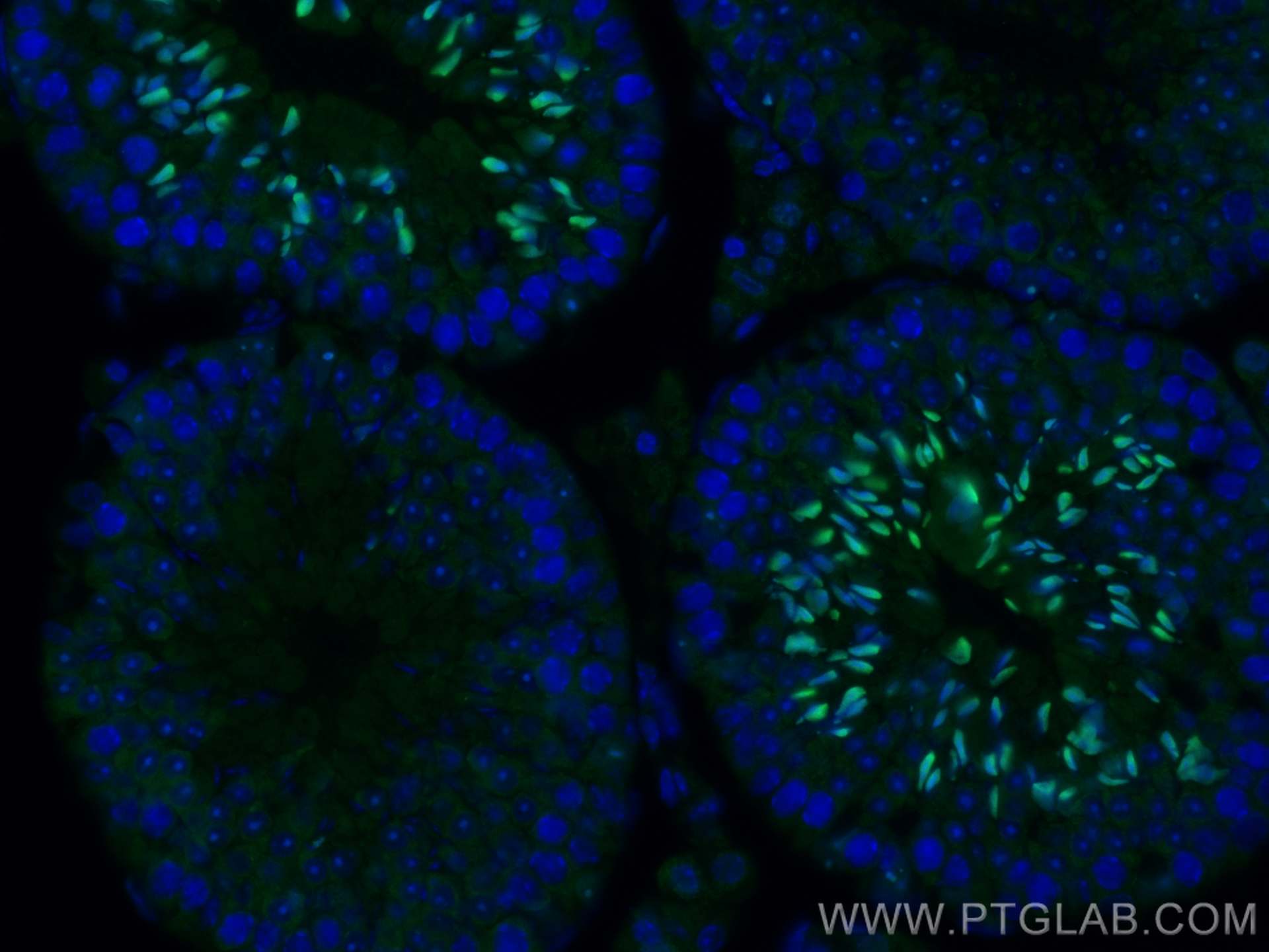 IF Staining of mouse testis using 25614-1-AP