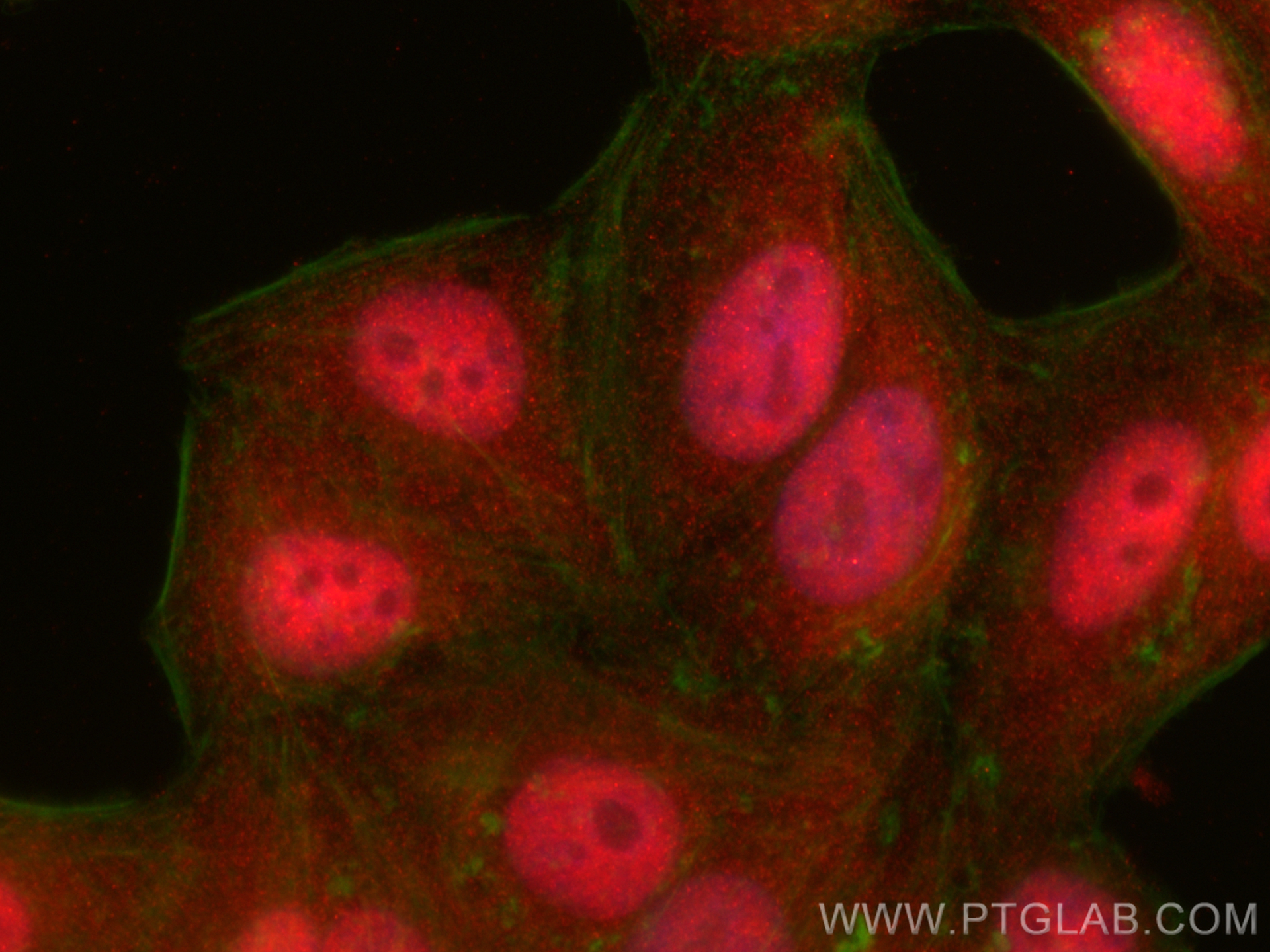 IF Staining of HepG2 using 25614-1-AP