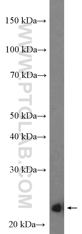P27; KIP1 Polyclonal antibody