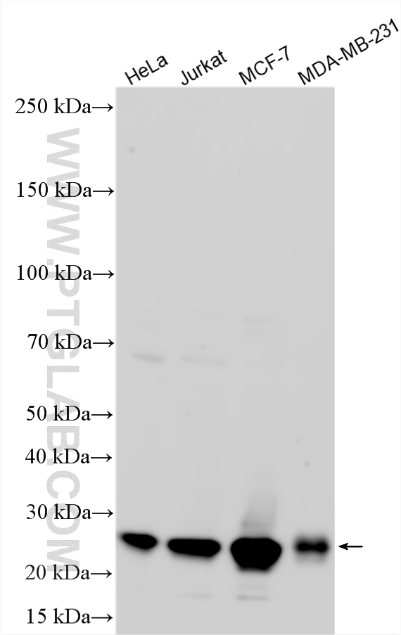 WB analysis using 25614-1-AP (same clone as 25614-1-PBS) WB analysis using 25614-1-AP (same clone as 25614-1-PBS)