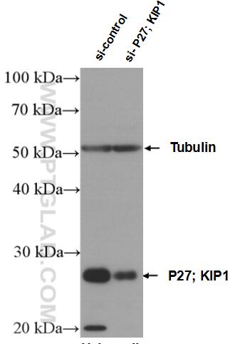 WB analysis of HeLa using 26714-1-AP