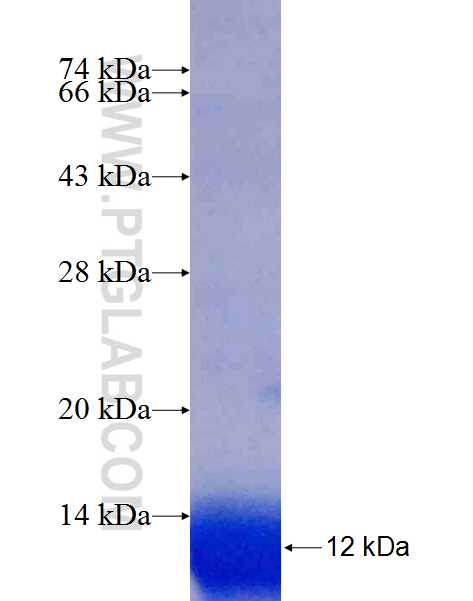 P27; KIP1 fusion protein Ag25104 SDS-PAGE