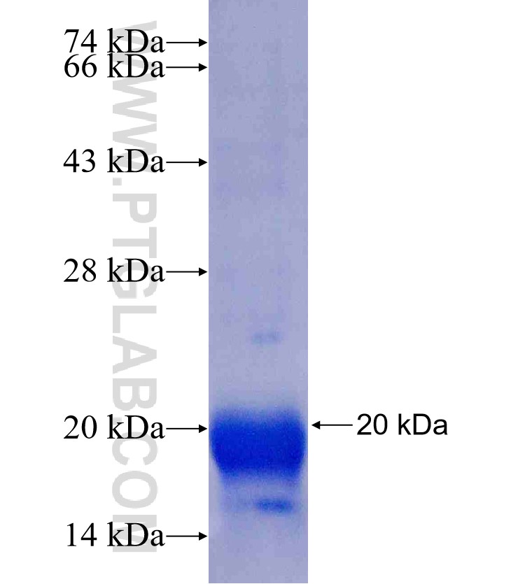 P27; KIP1 fusion protein Ag25104 SDS-PAGE