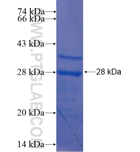 P27; KIP1 fusion protein Ag14634 SDS-PAGE