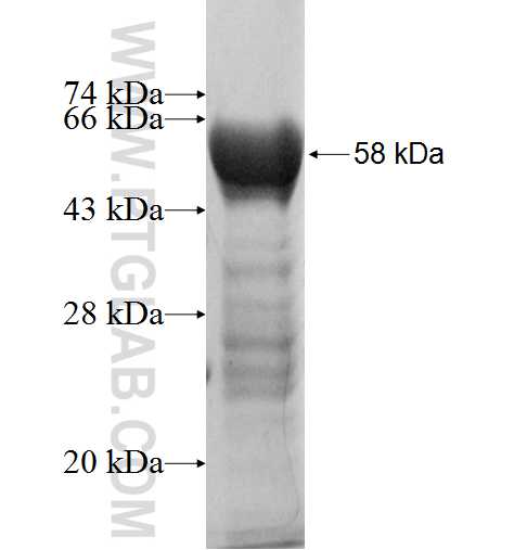 P27; KIP1 fusion protein Ag2280 SDS-PAGE