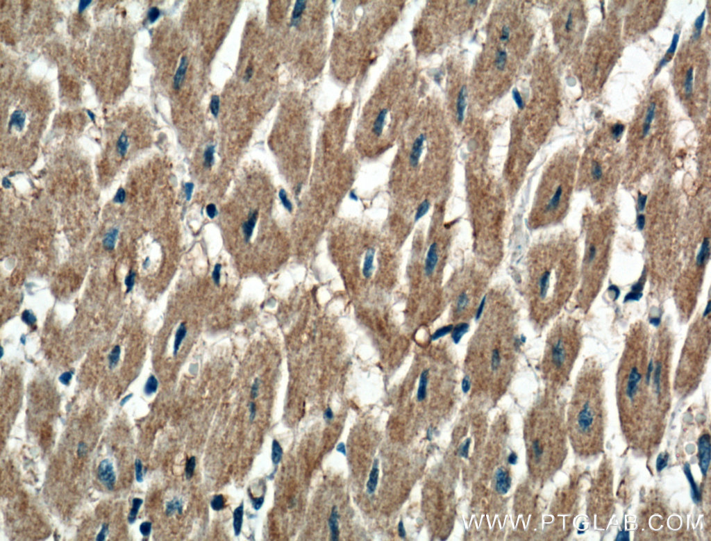 IHC staining of human heart using 17843-1-AP