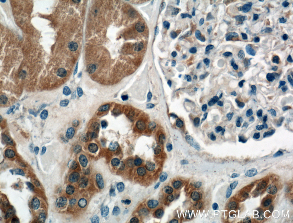 IHC staining of human kidney using 66416-1-Ig