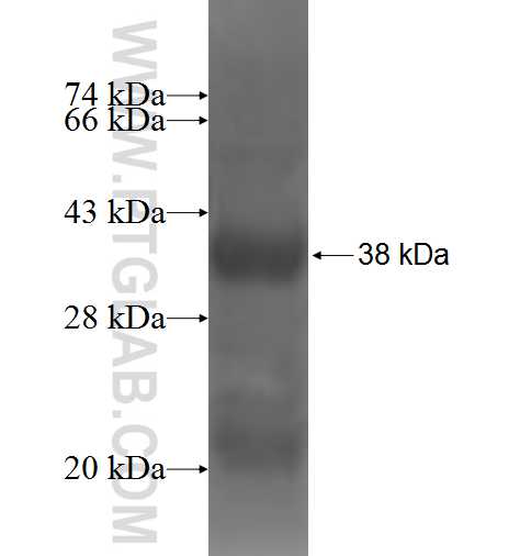 P2RX4 fusion protein Ag4635 SDS-PAGE