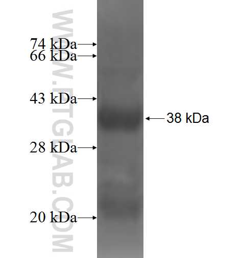 P2RX4 fusion protein Ag4635 SDS-PAGE P2RX4 fusion protein Ag4635 SDS-PAGE