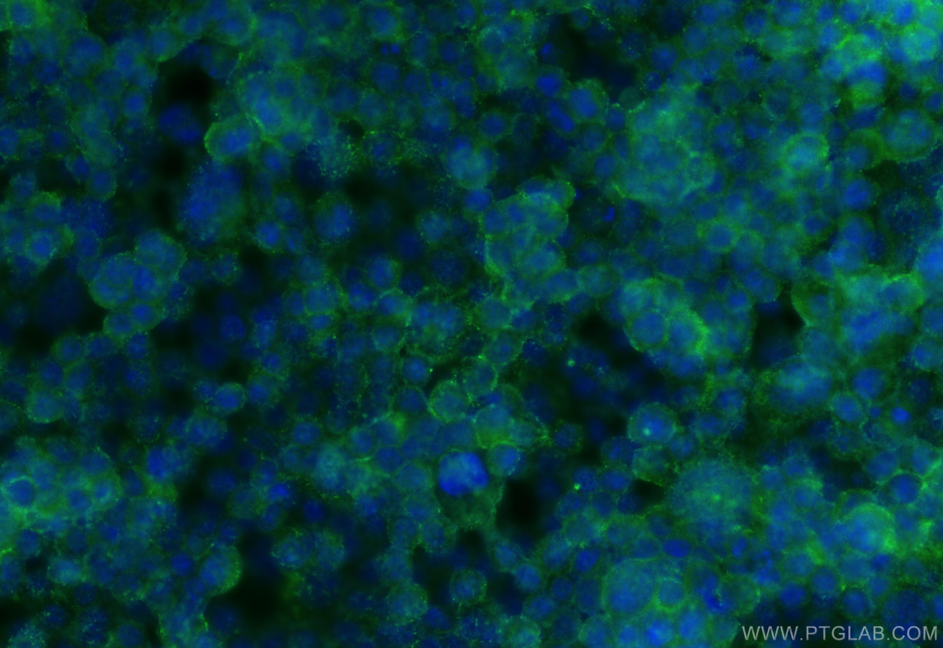 IF Staining of BxPC-3 using 19012-1-AP