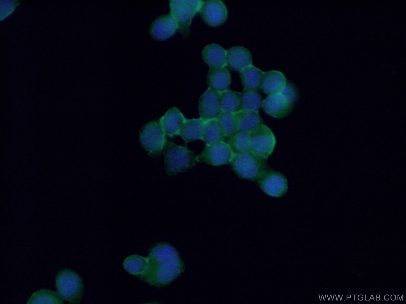 IF Staining of BxPC-3 using 19012-1-AP