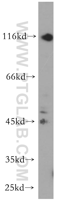 WB analysis of BxPC-3 using 19012-1-AP