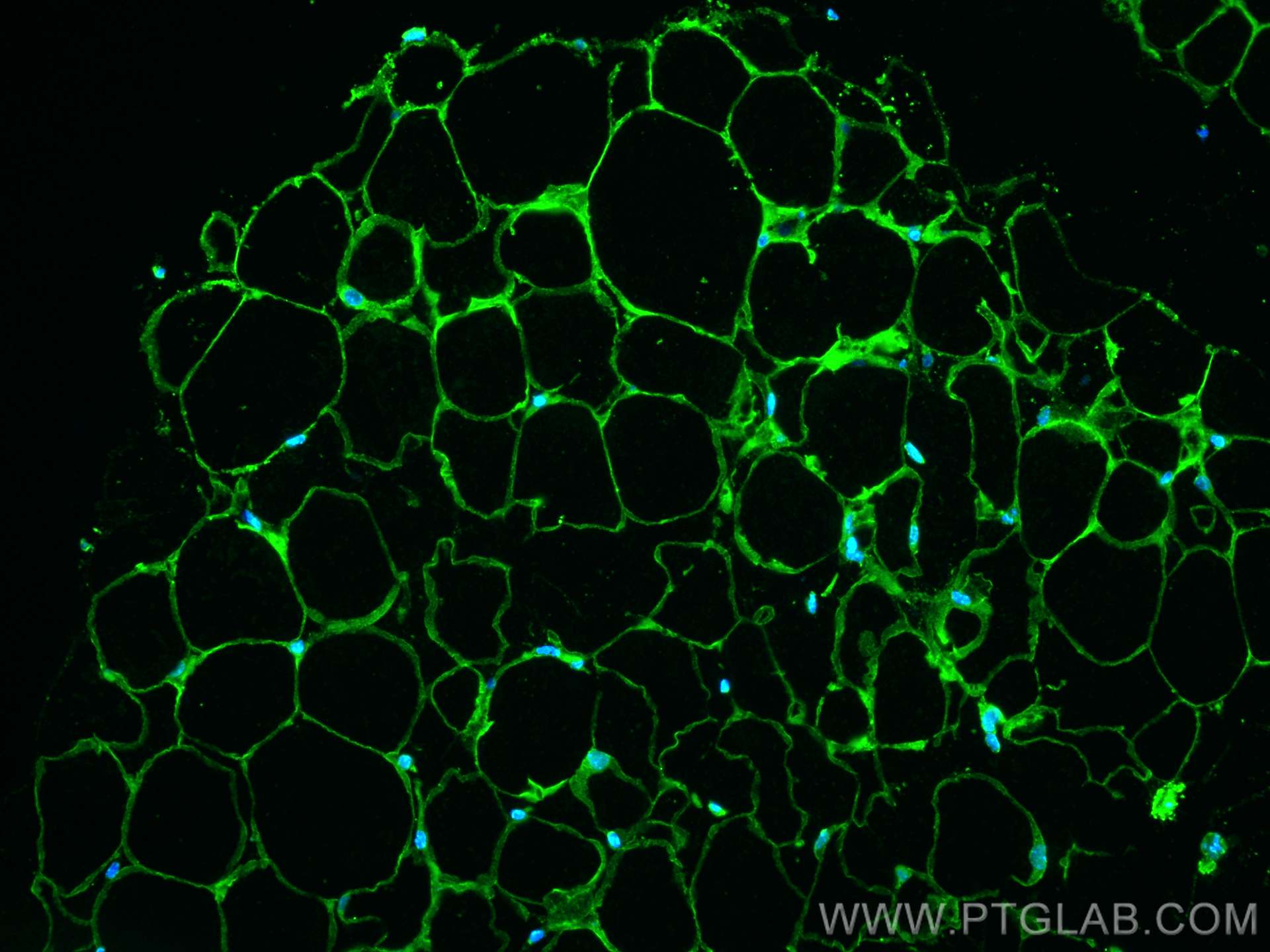 IF Staining of mouse brown adipose using 66430-1-Ig