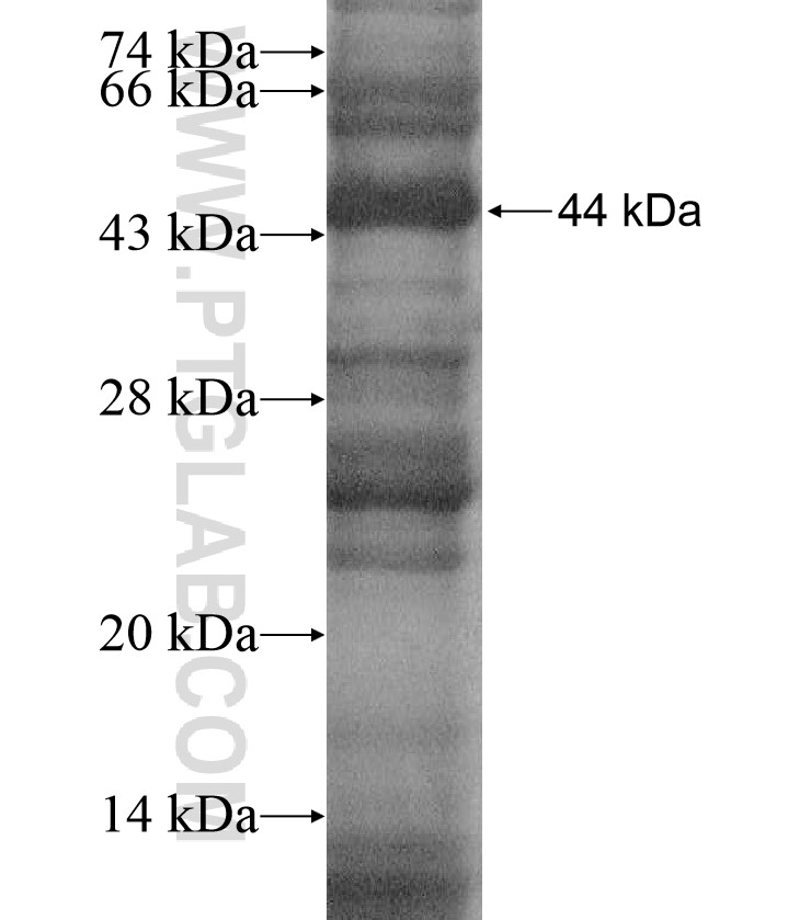 P2RX7 fusion protein Ag16932 SDS-PAGE P2RX7 fusion protein Ag16932 SDS-PAGE