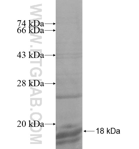 P2RY11 fusion protein Ag14498 SDS-PAGE P2RY11 fusion protein Ag14498 SDS-PAGE