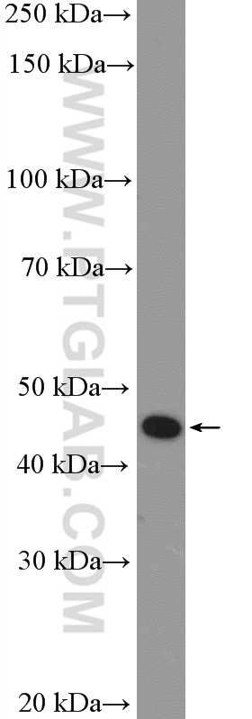 WB analysis of mouse spinal cord using 11976-1-AP (same clone as 11976-1-PBS)