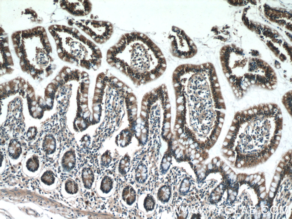IHC staining of human small intestine using 20335-1-AP