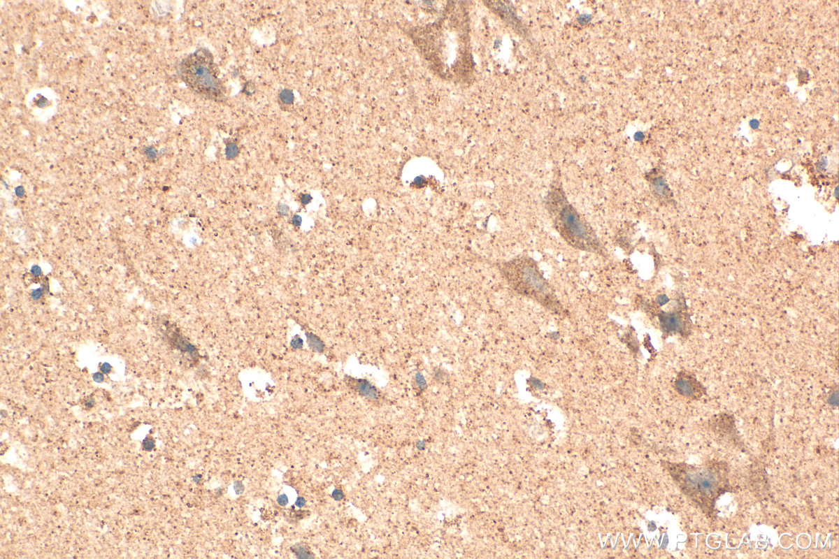 Immunohistochemical analysis of paraffin-embedded human brain tissue slide using 20297-1-AP (P2RY2 antibody) at dilution of 1:200 (under 40x lens). Heat mediated antigen retrieval with Tris-EDTA buffer (pH 9.0). IHC staining of human brain using 20297-1-AP