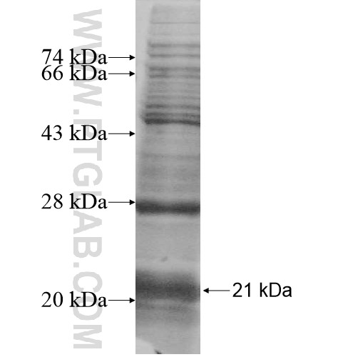 P2RY5 fusion protein Ag12564 SDS-PAGE P2RY5 fusion protein Ag12564 SDS-PAGE
