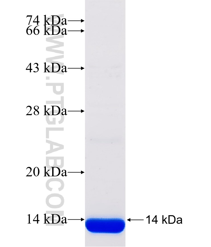 P2RY6 fusion protein Ag31387 SDS-PAGE