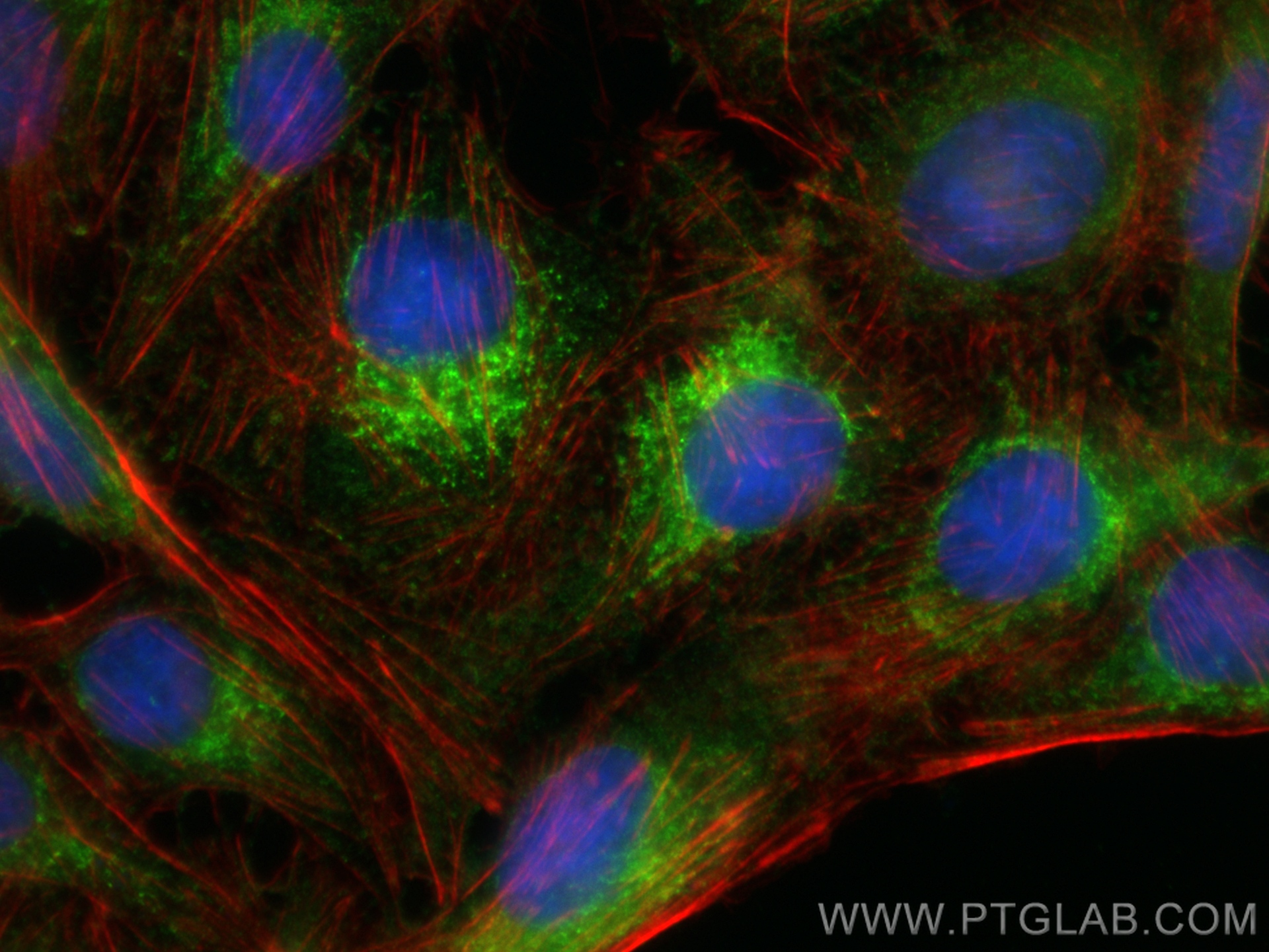 IF Staining of U2OS using 12658-1-AP