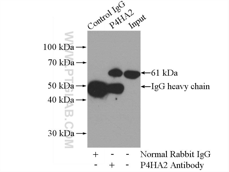 IP experiment of HeLa using 13759-1-AP