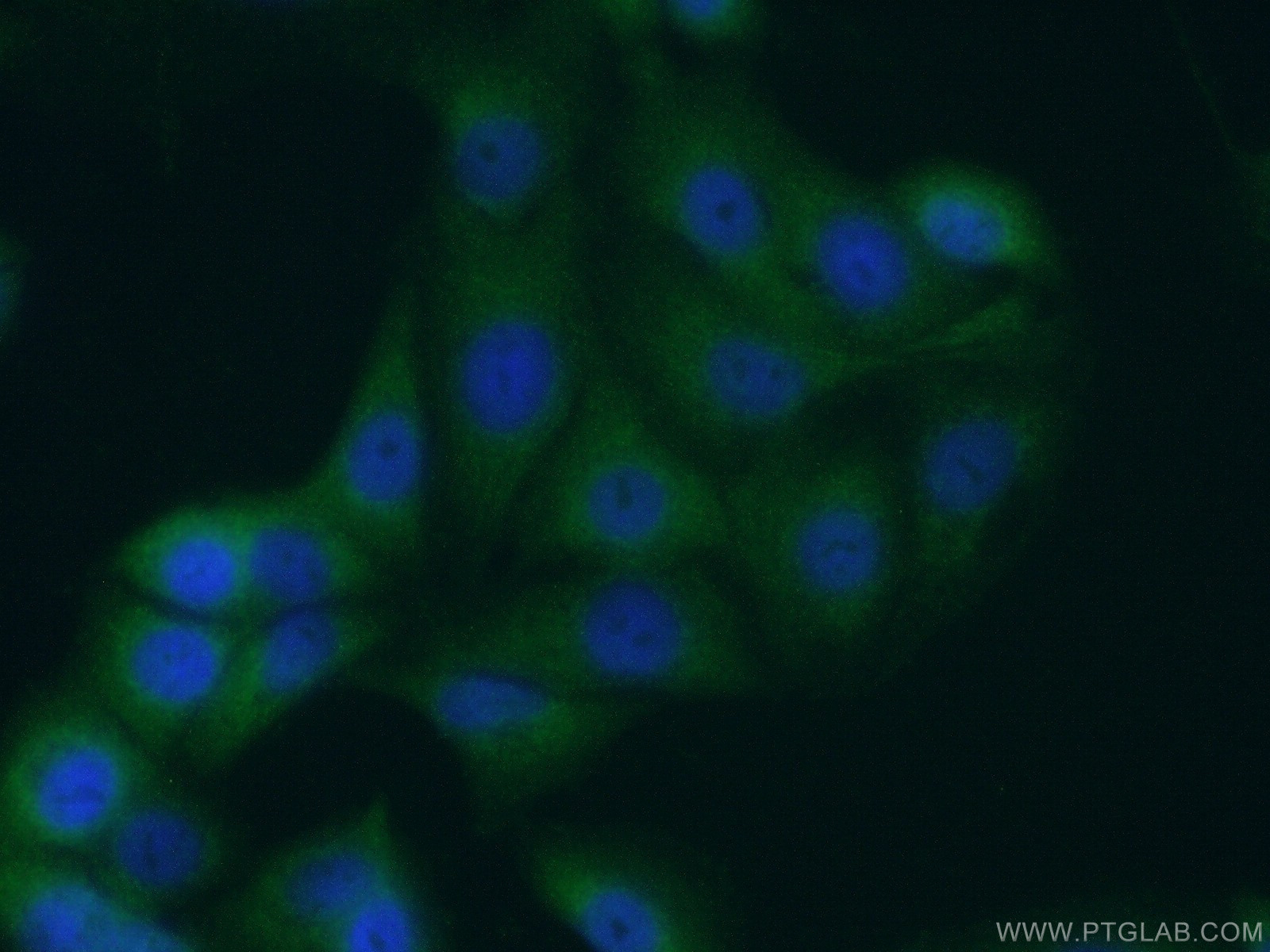 P4HA3 Polyclonal antibody