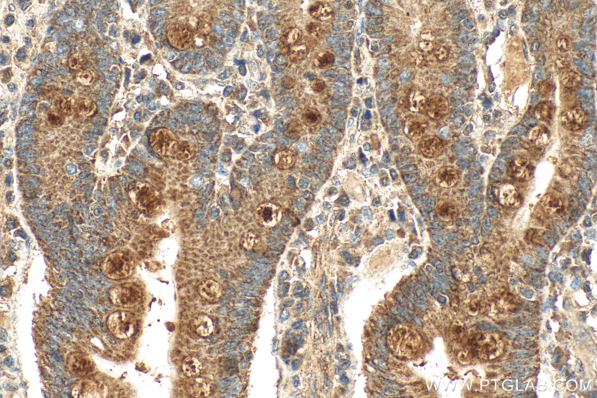 IHC staining of human small intestine using 23185-1-AP