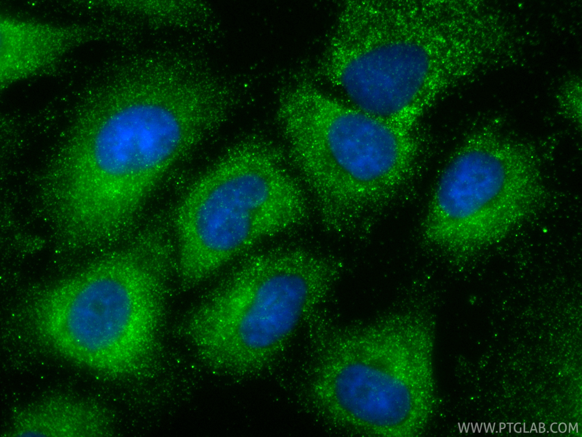 IF Staining of A549 using 85374-1-RR IF Staining of A549 using 85374-1-RR
