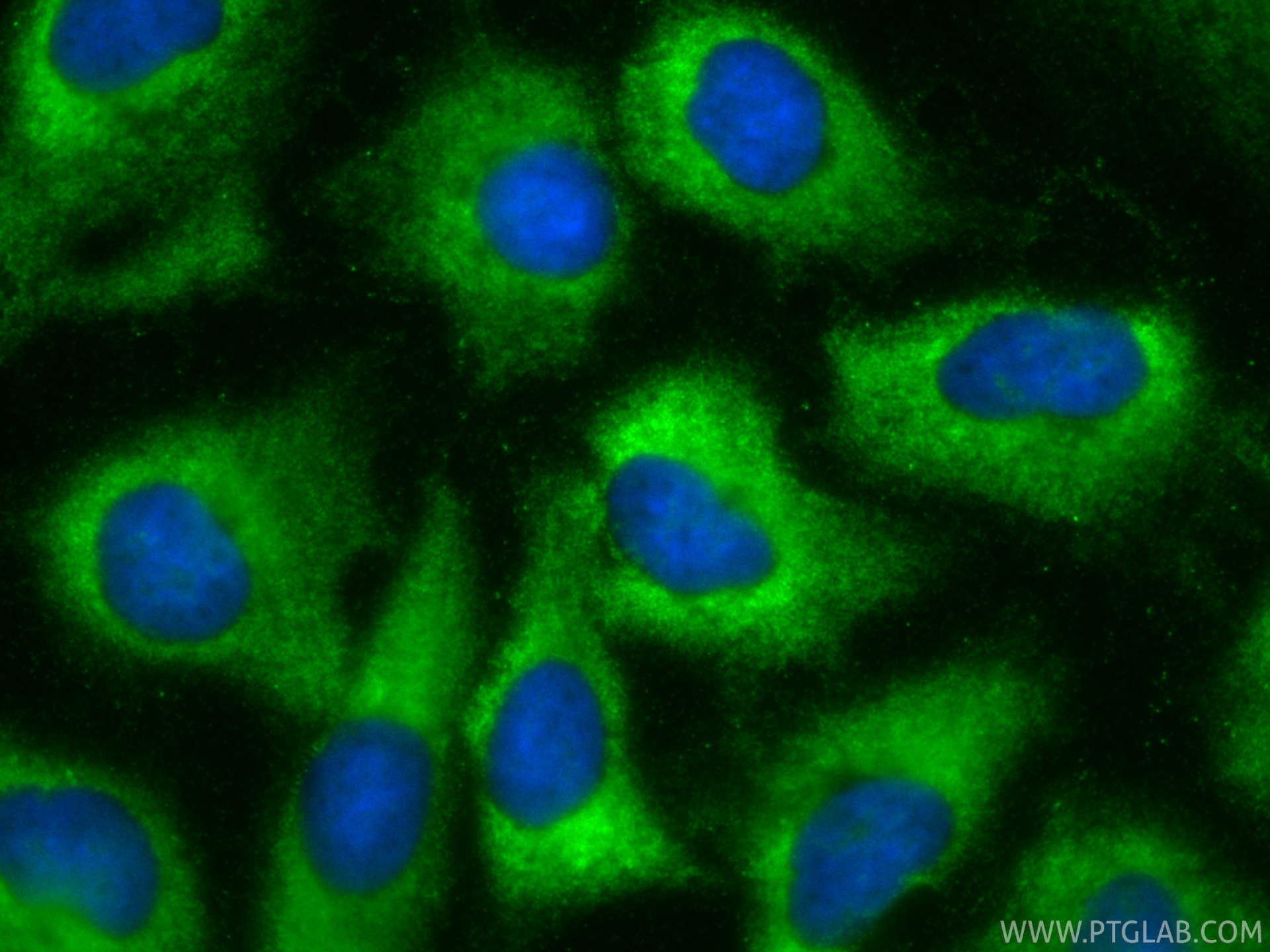 IF Staining of A549 using CL488-85374