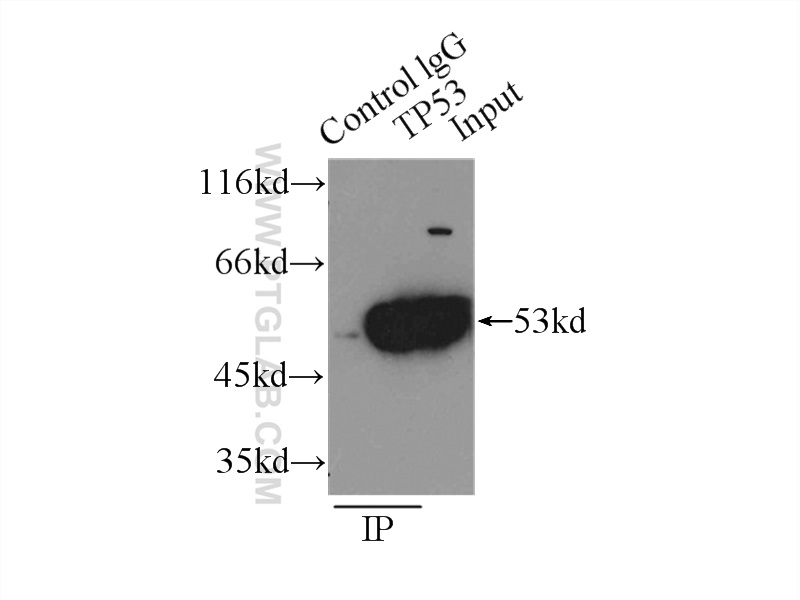 P53 Polyclonal antibody