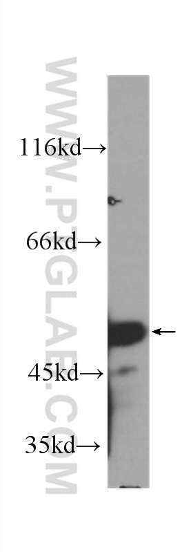 P53 Monoclonal antibody