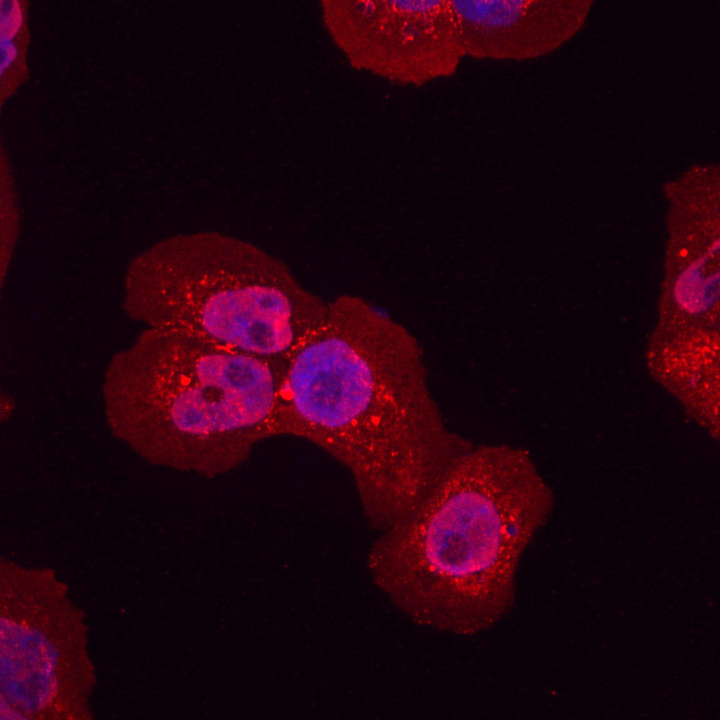 IF Staining of A431 using 80077-1-RR