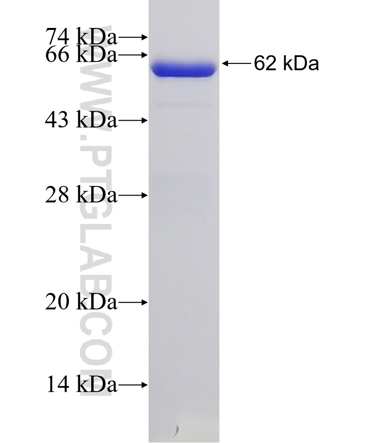 P53 fusion protein Ag0698 SDS-PAGE