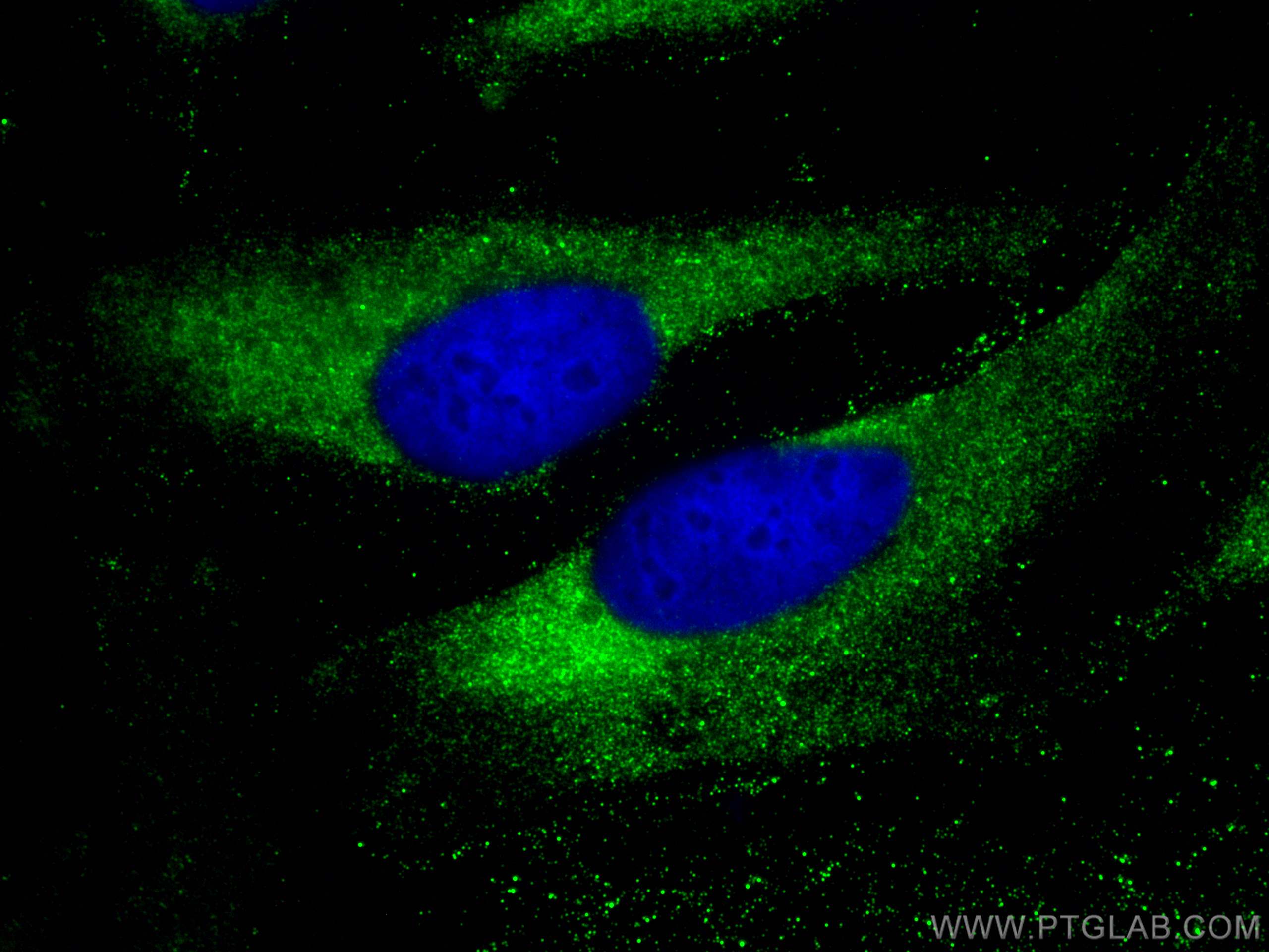 IF Staining of HeLa using 14632-1-AP