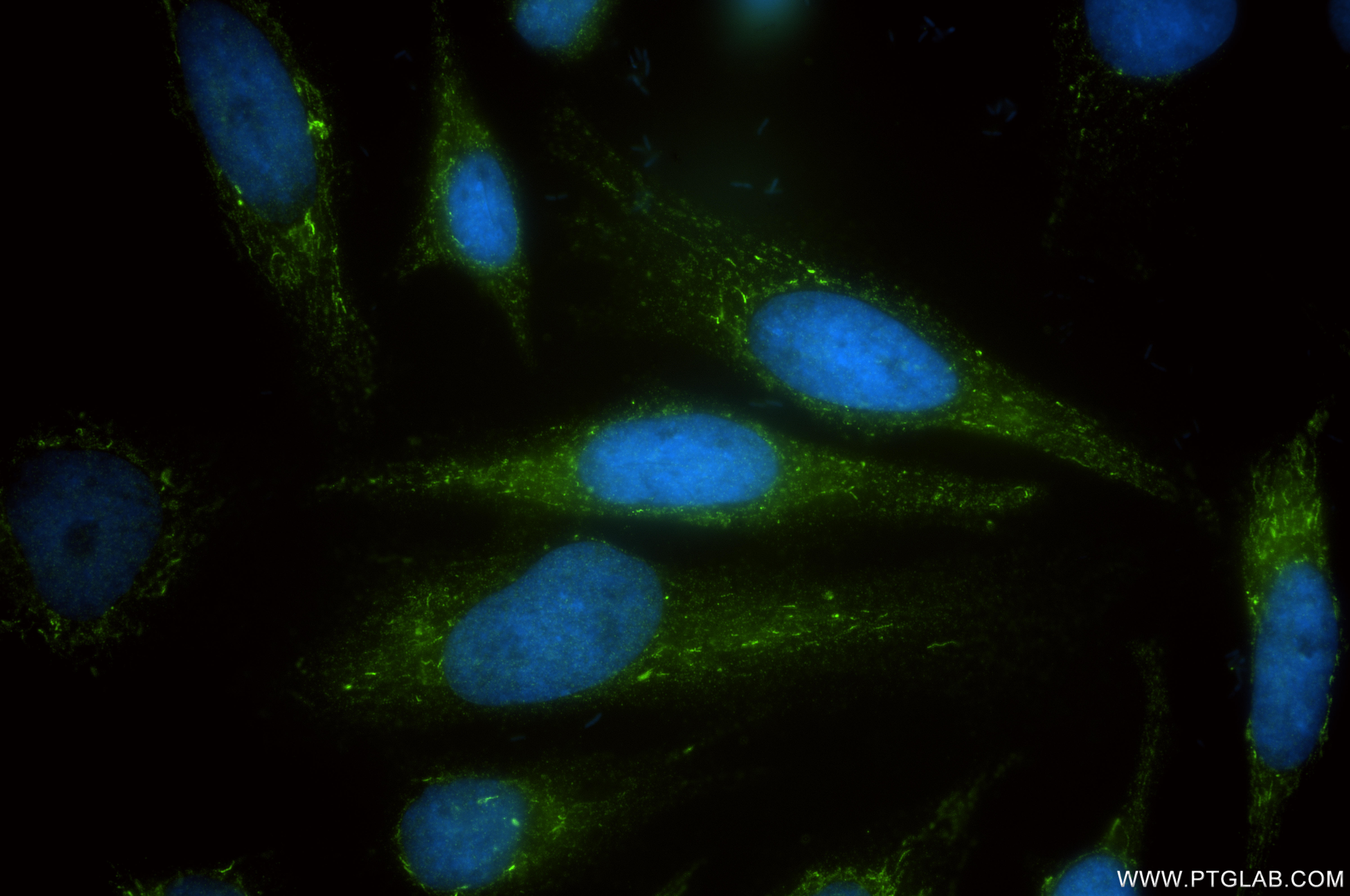 IF Staining of HeLa using 87037-1-RR (same clone as 87037-1-PBS)