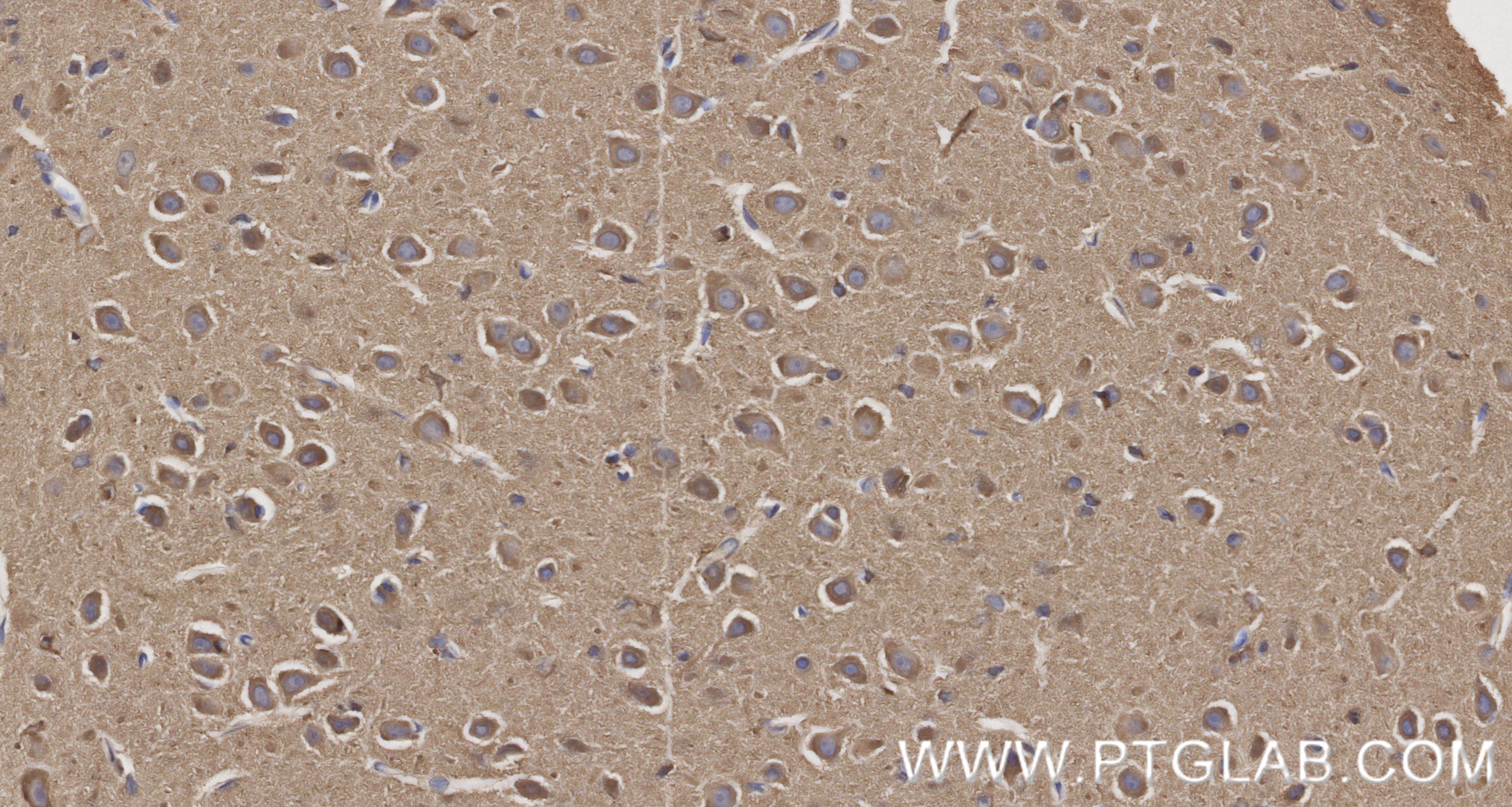 IHC staining of rat brain using 87037-1-RR (same clone as 87037-1-PBS)
