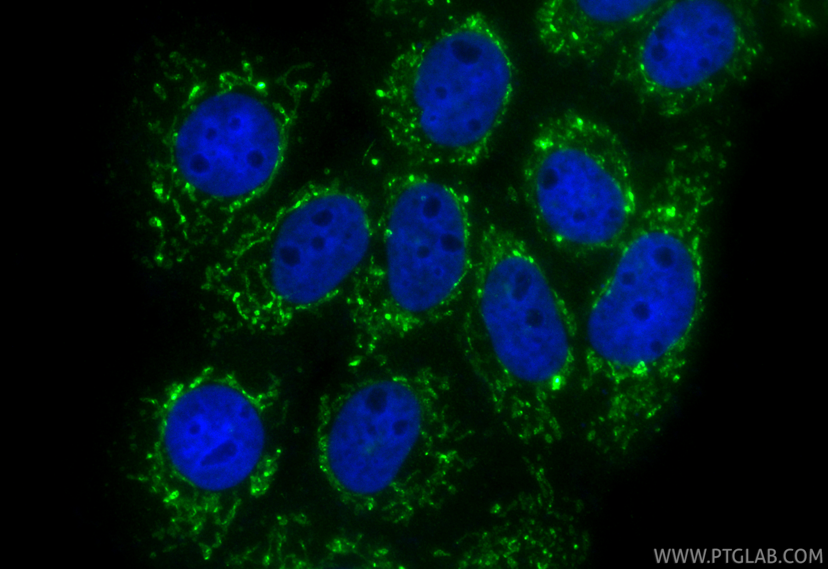 IF Staining of A431 using CL488-17719 IF Staining of A431 using CL488-17719