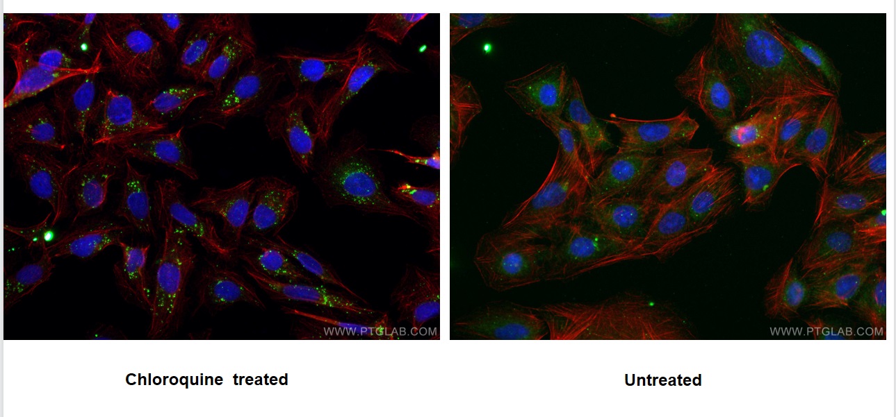 IF Staining of U2OS using 66184-1-Ig