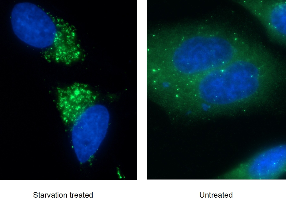 P62,SQSTM1 Monoclonal antibody