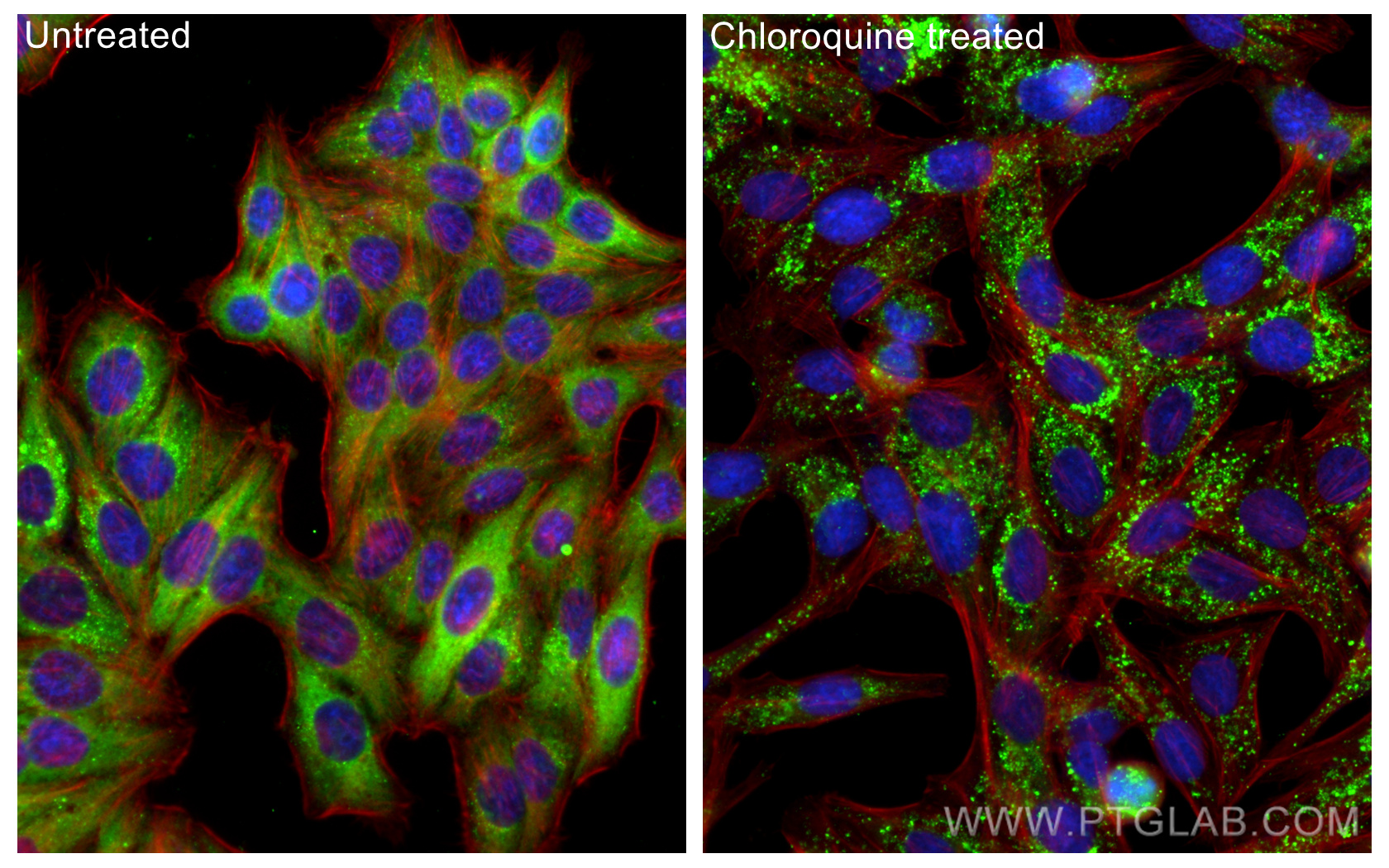 IF Staining of HepG2 using 66184-1-Ig
