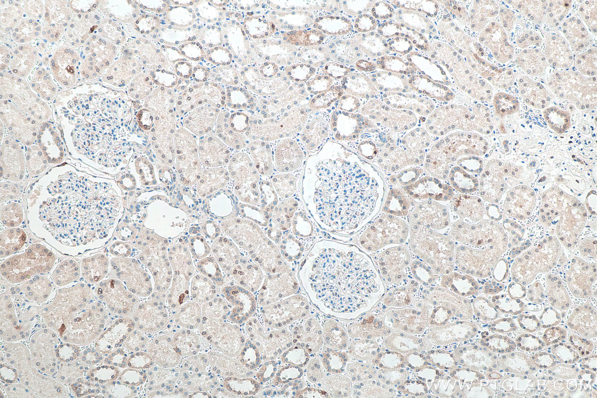 IHC staining of human kidney using 66184-1-Ig