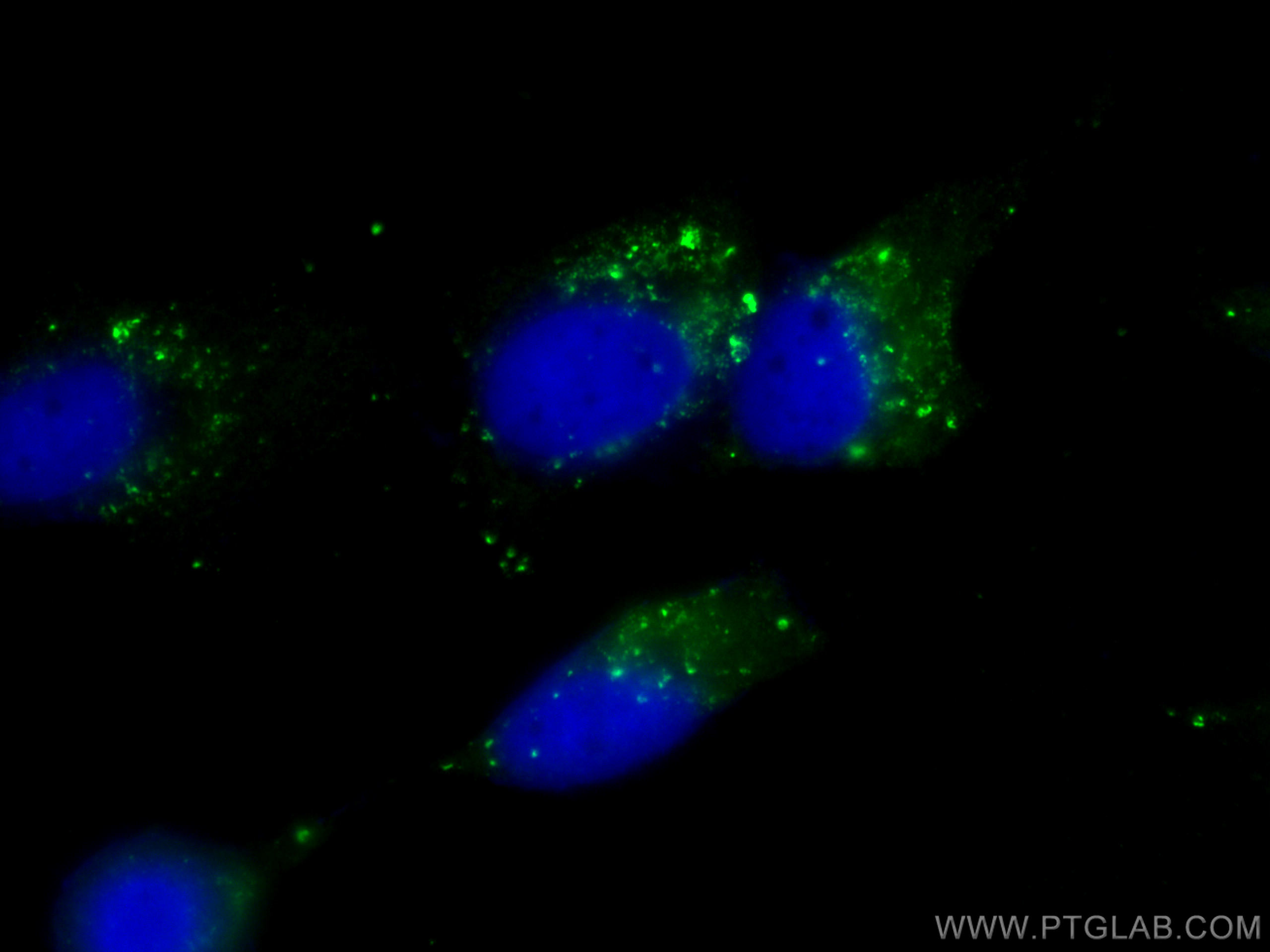 IF Staining of HepG2 using CL488-66184