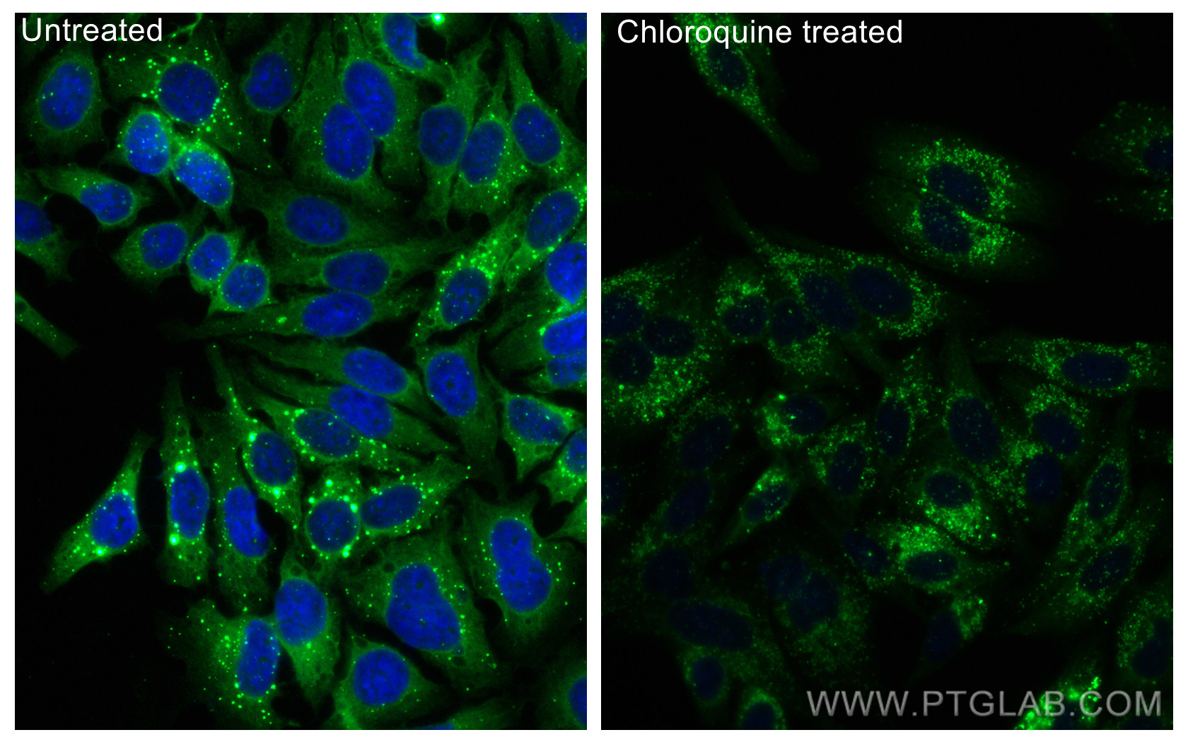 IF Staining of HepG2 using CL488-80294