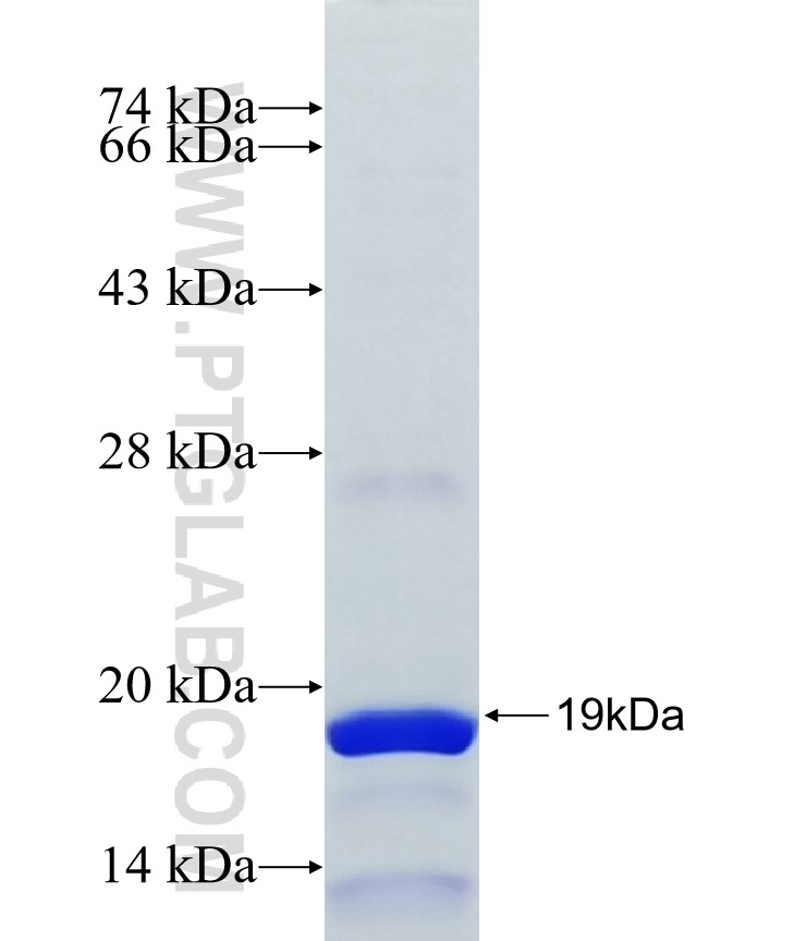 P85a; PIK3R1 fusion protein Ag25394 SDS-PAGE