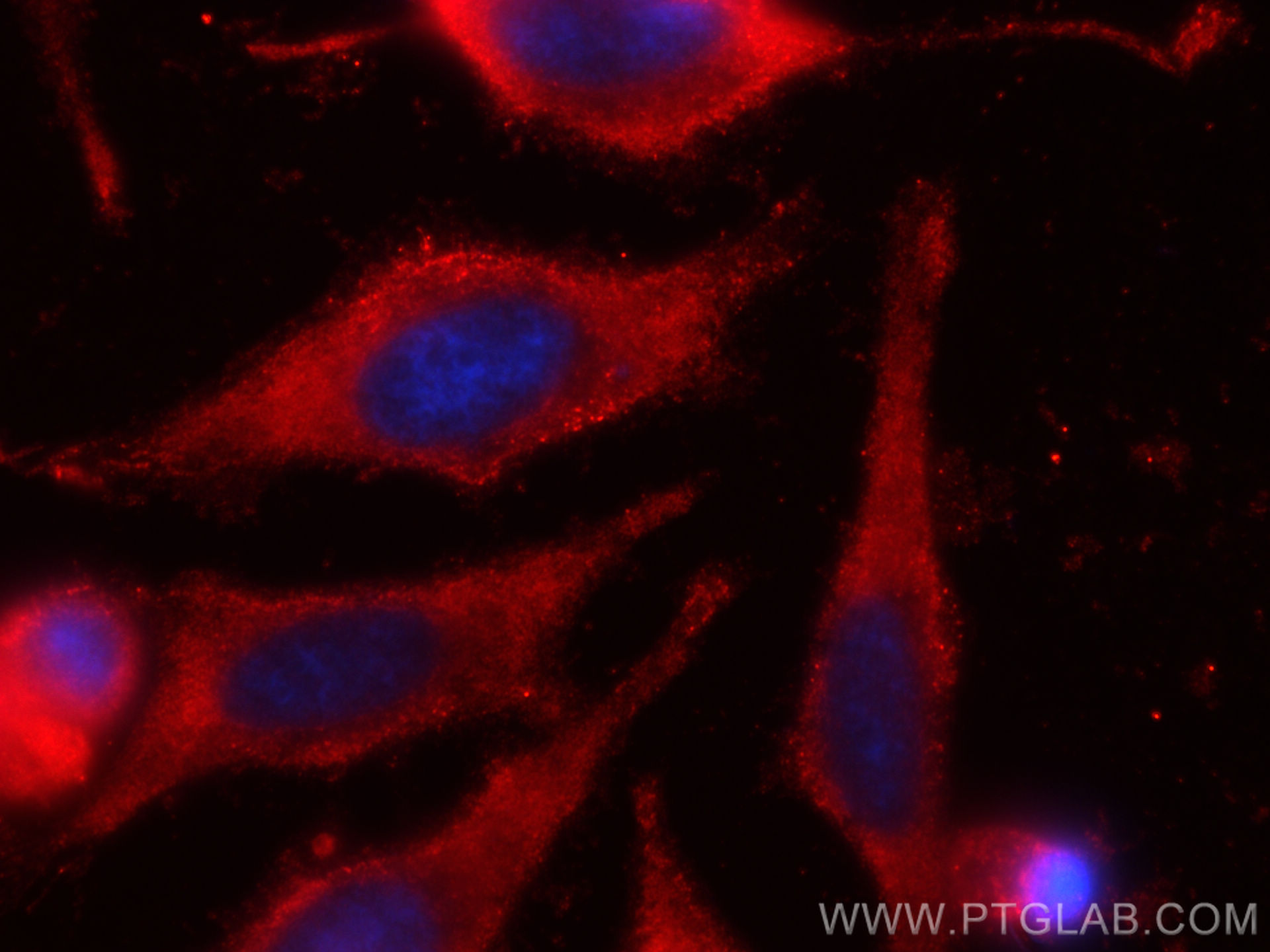 IF Staining of HeLa using CL594-66055